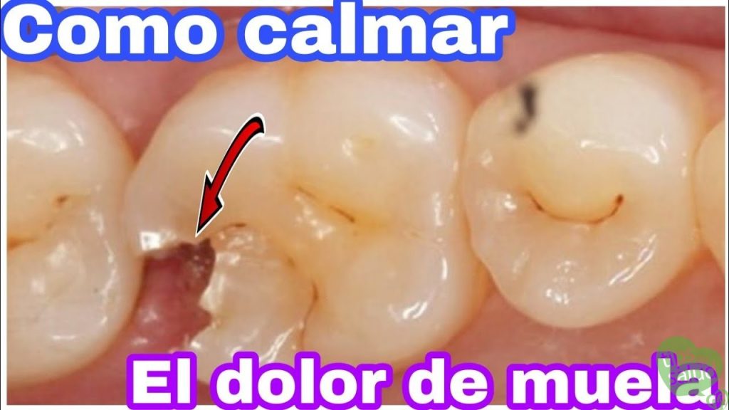 Dolor de Muela