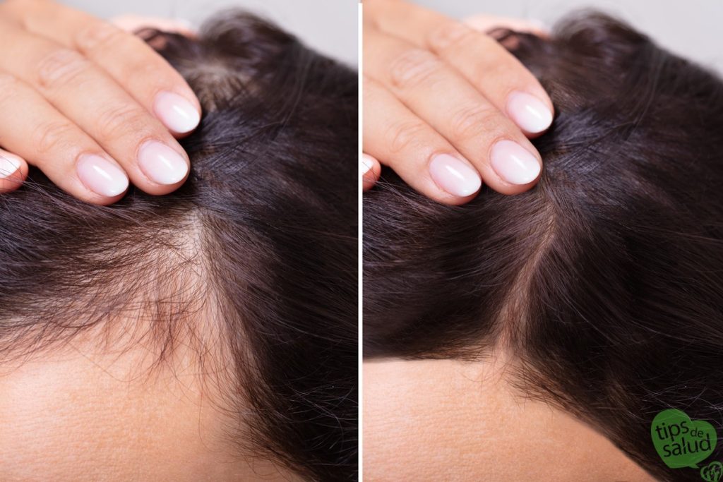 Hacer Crecer el Cabello